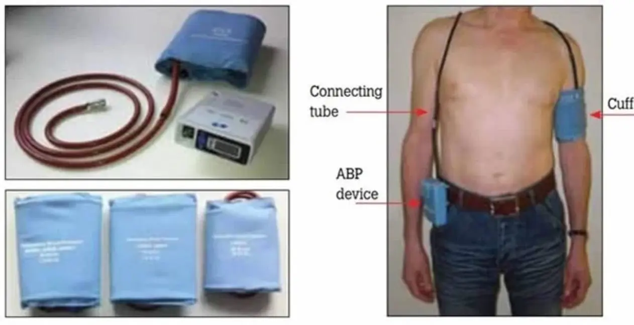 Ambulatory BP monitoring